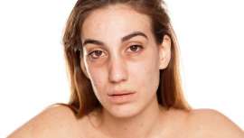 Los seis vicios de la vida moderna que pasan factura y fichan a nuestra piel y rostro y la 6 respuestas de dos especialistas, el Dr. José Vicente Lajo-Plaza, Clínica Lajo Plaza, y Patricia Cuenca, directora técnica de Centro Oxigen