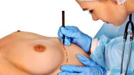 La última técnica en mamoplastia