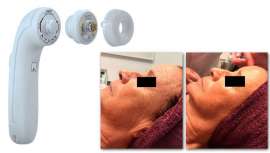 Wishpro te ofrece el tratamiento perfecto que asegura el rejuvenecimiento inmediato. Fusión de tecnologías, pulso magnético y microcorriente más cápsula con los principios activos más eficaces para una acción definitiva desde la primera sesión