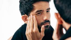 La cirugía plástica demuestra que los hombres también tienen vanidad. En casos extremos, porque quieren ser iguales a sus selfies retocados o a sus superhéroes favoritos. Aunque también están aquellos que sólo pretenden verse mejor