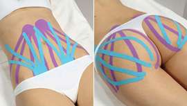 El Kinesiotaping o Vendaje Neuromuscular es un método de vendaje revolucionario, innovador, increíblemente efectivo y muy de moda hoy día en todo el mundo. Descubre las vendas de colores.