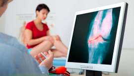 Incapacitante en buena medida y dolorosa, así es la artrosis. Revisamos con Clínicas Rozalen el origen de esta enfermedad degenerativa y marcamos sus pautas para evitar su aparición temprana