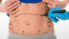 Existen razones de peso para someterse a cirugías de este tipo precisamente en la época previa al comienzo de la primavera