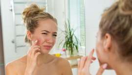 Los resultados de este producto, que verá la luz a mediados de 2019, demuestran una mejora duradera de un 85%  del acné al año