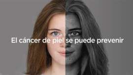 La firma lanza la campaña El cáncer de piel se puede prevenir, en colaboración con la farmacia española