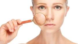 A importância de saber identificar pontos de pele