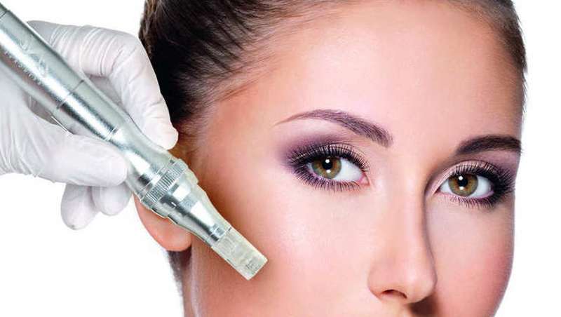 Microneedling e Microchanneling, um universo de diferenas ou semelhanas?