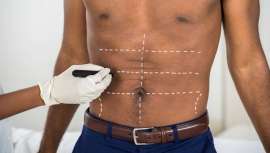 El sexo masculino accede a la cirugía y medicina estética de igual modo que lo hace la mujer, un símbolo más de la estabilidad social, como comprar un coche y una casa. Entre ellos, el colectivo gay destaca como uno de los que más crece en demanda