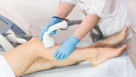 Disfrutar de uma depilação a laser sem carga muscular nem lesões no pescoço, ombro, braço ou costas, sobretudo em relação a sistemas de varrer ou SHR, é uma assinatura pendente que agora Grupo Slyou e Coolite revelam e colocam em prática