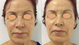 ¿Preocupado o preocupada por la cuenta de resultados? ¿No te salen los números? ¡Olvídate de pagar por tus equipos y aparatología de belleza! Sí, has leído bien, ya no tendrás que pagar tus máquinas. Llega Estetiplan, tu mejor plan