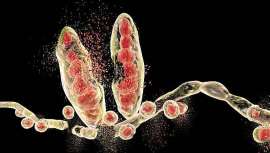 Infección por hongos que se instala con cierta frecuencia en el cuero cabelludo, revisamos tipos y clases, síntomas, tratamiento y prevención para tu seguridad en el salón de peluquería y la de tu cliente