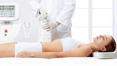 Scizer, la reducción del tamaño