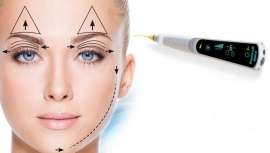 La última tecnología se pone al servicio del rejuvenecimiento de la mirada, tensando los párpados retraídos por motivos como la edad y el cansancio
