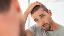 Perder más de entre 50 a 80 cabellos al día, que es la caída media en el ciclo de vida del pelo, puede indicar el inicio de un problema de alopecia 