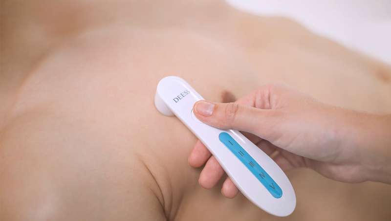 Medidor laser de fottipos de melanina para uma depilao profissional