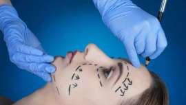 Este 2020 seguiremos hablando de cirugía y medicina estética en las publicaciones de belleza, los periódicos y, sobre todo, en las redes. Lugares donde se apuntan cuáles van a ser sus tendencias y que revisa para nosotros Moisés Martín Anaya