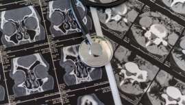 Al acabar este curso, en el mes de mayo, se realizarán talleres prácticos optativos para los alumnos interesados