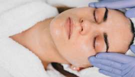 Ester Herranz, directora de Nuevo Concepto Estética Avanzada de Burgos, explica cómo lucir un cutis radiante y lleno de vitalidad tras las celebraciones de Navidad