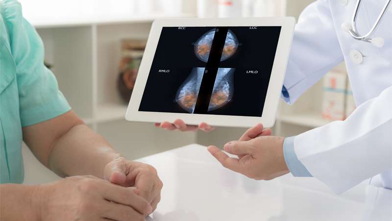 Detección cáncer de mama, ¿la IA más eficaz que la radialogía?