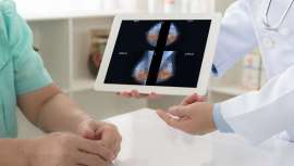 Google ha desarrollado un sistema de IA, Inteligencia Artificial, basado en un algoritmo que detecta con mayor precisión que los radiólogos el cáncer de mama