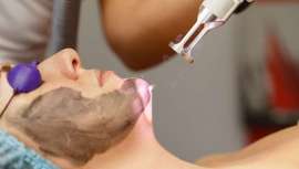 Un Campus virutal, el de NutriDermoVital, que en este caso nos presenta su formación para el uso del Carbon Peel, Peeling de carbono con láser Q-Switched de Nd-Yag