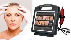 Marca la diferencia con microcirugía no invasiva, plasma fraccionado Plasmage de Tormamed, para blefaroplastia no quirúrgica, un tratamiento cada vez más demandado por los pacientes en la consulta de dermatología y medicina estética