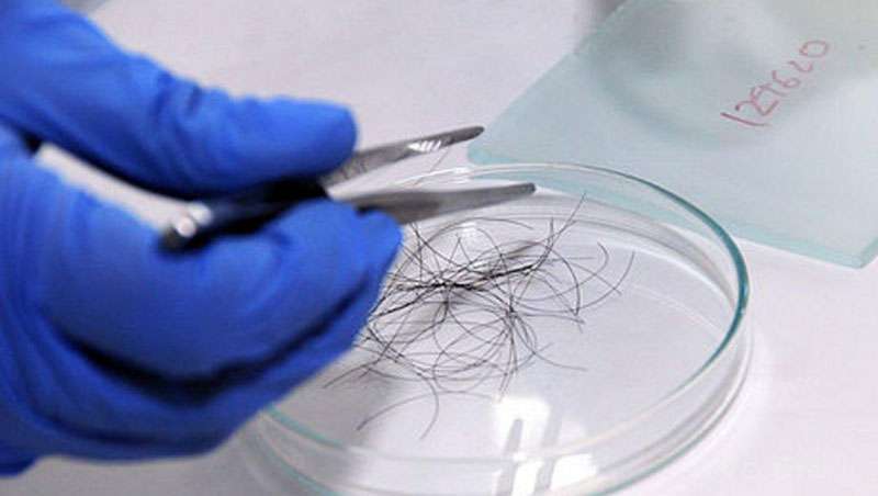 Os nveis de stress podem medir-se atravs de amostras de cabelo