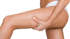 Los especialistas de Lamdors Global System estiman que la piel de naranja y la flaccidez corporal han podido incrementarse hasta un 30% durante la etapa de confinamiento 