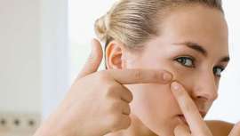 Acné, puntos negros y espinillas, bajo control y a buen recaudo con el uso y tratamiento de ácido salicílico, además de otros beneficios para la salud y belleza de la piel