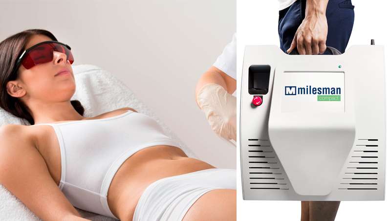 Milesman Compact, el avance definitivo en lser de diodo para depilacin