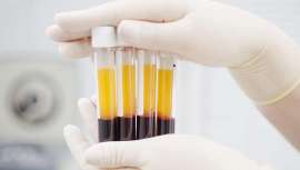 Los webinars de IMCAS Academy permiten disfrutar de conferencias de expertos y participar en la discusión en tiempo real, desde cualquier lugar 