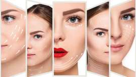 En Francia, y según un estudio de Xerfi-Percepta, este mercado no recuperaría su nivel de actividad del año 2019, antes de finales del próximo ejercicio 