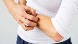 La histamina  interviene decisivamente en las reacciones de hipersensibilidad inmediata y alérgica que se produce especialmente en primavera y verano. Revisamos fundamentos, cosméticos recomendados, así como su proceso y desarrollo 