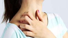 Esta enfermedad se caracteriza por brotes inflamatorios reconocibles por sus placas rojas y una gran sequedad de la piel acompañada de picor