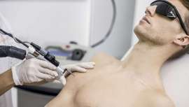 La foliculitis aparece cuando se enquista un pelo facial o corporal o se infecta, en hombres y mujeres. Revisamos causas y descubrimos cómo Elite iQ, de Cynosure, asegura la destrucción del folículo piloso acabando por fin con tan molesto problema