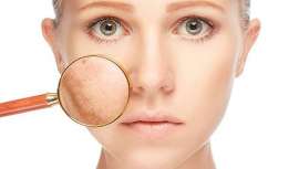 Se recomiendan tratamientos que favorezcan la eliminación de toxinas, drenantes y que estimulen el metabolismo de las grasas