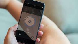 Los dermatólogos están utilizando la IA para diagnosticar el cáncer de piel a distancia en la crisis sanitaria derivada del Covid-19