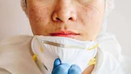 Granitos que se apoderan del rostro por el uso y roce de la mascarilla en la pandemia. Obligados a llevarla, la piel se resiente y se produce el denominado efecto maskné ¿Por qué? Lo descubrimos y ponemos freno con consejos y cosmética específica