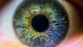 Hungría. Año 1836. Un niño al intentar atrapar a un búho le rompió una pata. Casualmente miró a los ojos del animal y observó cómo le aparecía una mancha negra en el iris...