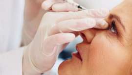 Especialistas discrepan. El doctor José Vicente Lajo Plaza, del Centro Médico Lajo Plaza, nos advierte sobre las rinomodelaciones con ácido hialurónico, de moda y que arrasan entre instagramers