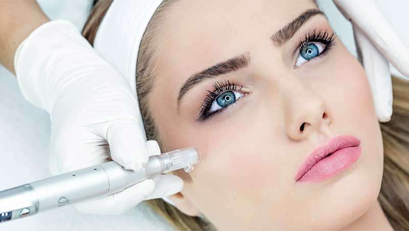 Optimizar el efecto del microneedling con radiofrecuencia