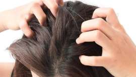 Espejo de distintas enfermedades sistémicas, el próximo congreso de la EADV discutirá acerca de uñas y cabello, analizando los tipos de caída y diagnóstico con tricoscopia, dermoscopia capilar y del cuero cabelludo