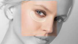 La razón de que este problema estético se manifieste de forma tan prematura es la multiplicidad de factores que lo desencadenan y que van más allá de la edad