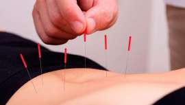 SESMI, Sociedad Española de Salud y Medicina Integrativa, reivindica el valor y papel esencial de esta técnica en el ámbito terapéutico, sobre todo en lo referido al tratamiento del dolor y diversas patologías, con resultados terapéuticos 