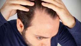 A queda do cabelo no outono não se deve atribuir apenas à mudança da estação como também a outras causas que se produzem durante todo o ano, como o caso do dano na estrutura capilar, o stress ou o excesso de sebo. Por isso, há que eleger a melhor s