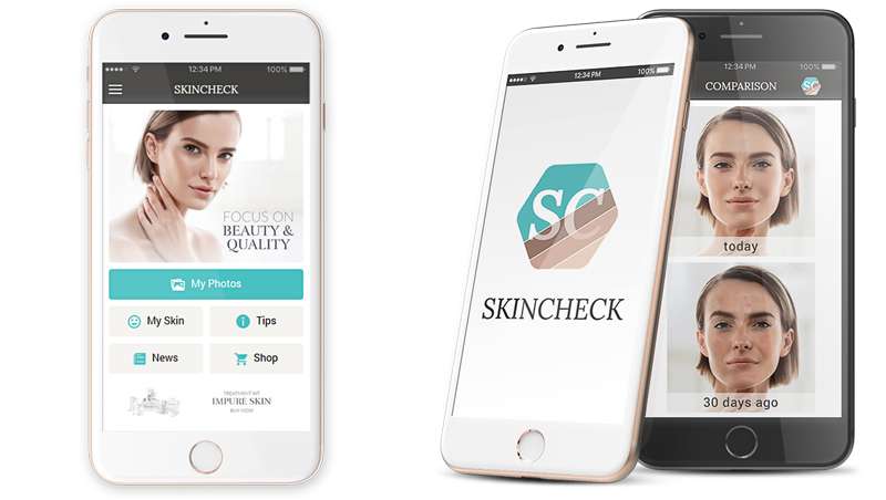 SkinCheck, la app que diagnostica la piel