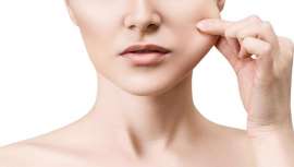 Consiste en la extracción parcial de un cúmulo de grasa que existe en el lateral de la boca, en la parte baja de la mejilla, denominado Bola de Bichat