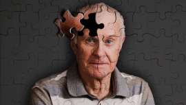 Un hallazgo de la Clínica DKF utilizado en el deterioro cognitivo ligero y Alzheimer precoz