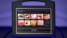 Tecnología contra las arrugas, entre otros usos antiaging, avalada por el Dr. Contreras Sánchez J. en su artículo científico sobre Plasmage, estudio publicado por la SEME, Sociedad Española de Medicina Estética