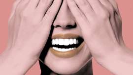 La sonrisa gingival hasta ahora era territorio de la toxina botulínica en medicina estética, actualmente tiene una nueva y más natural solución con el ácido hialurónico